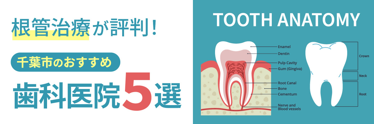 根管治療も受けられる！千葉市のおすすめ歯科医院５選